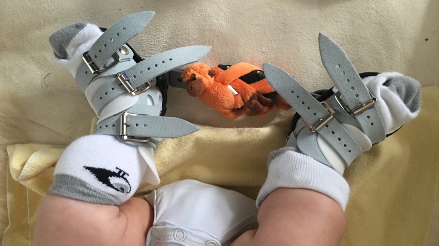 2 Klumpfuss-Kinder-Sachbücher  "Meine besonderen Füsse"