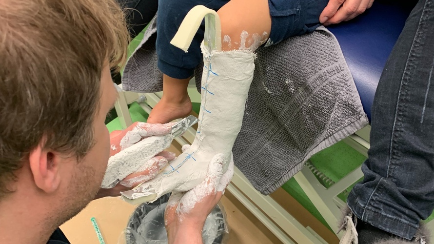 2 Klumpfuss-Kinder-Sachbücher  "Meine besonderen Füsse"