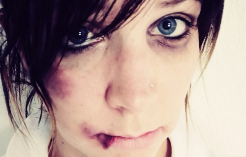 Opération coup de poing