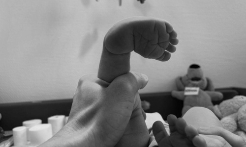 2 Klumpfuss-Kinder-Sachbücher  "Meine besonderen Füsse"