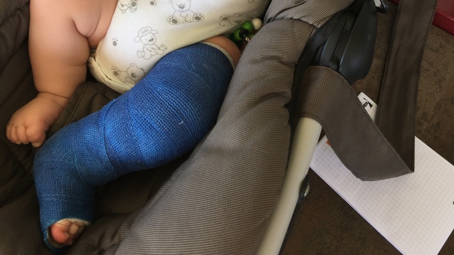 2 Klumpfuss-Kinder-Sachbücher  "Meine besonderen Füsse"